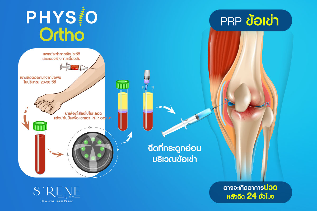 ขั้นตอนการฉีด PRP บริเวณเข่า