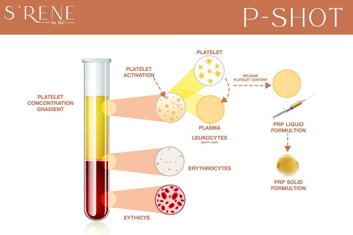 SRENE P Booster P Shot (PRP) - 2