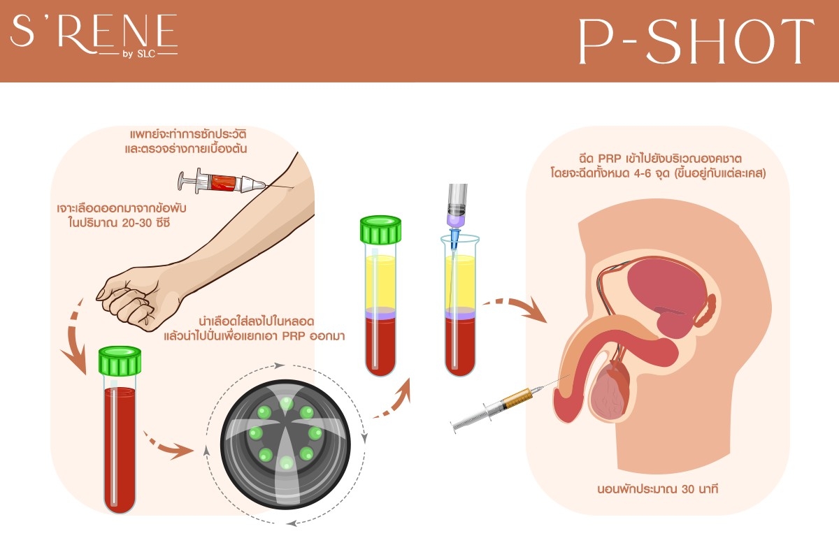 SRENE P Booster P Shot (PRP) - 5