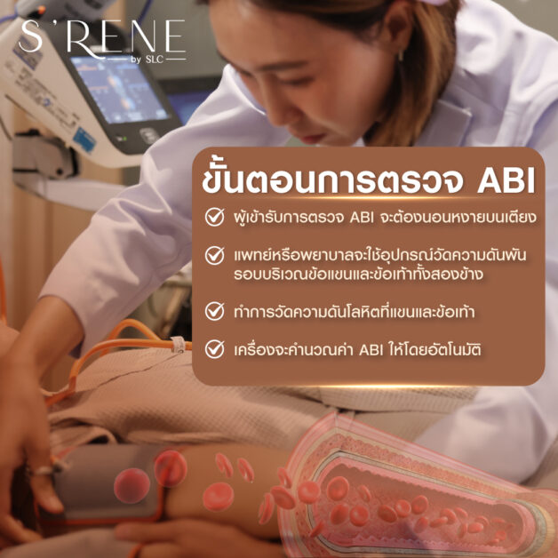 เครื่องตรวจ ABI