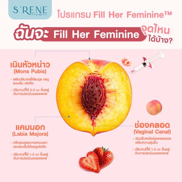 ฟิลเลอร์น้องสาว