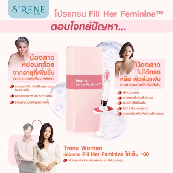 ฟิลเลอร์น้องสาว